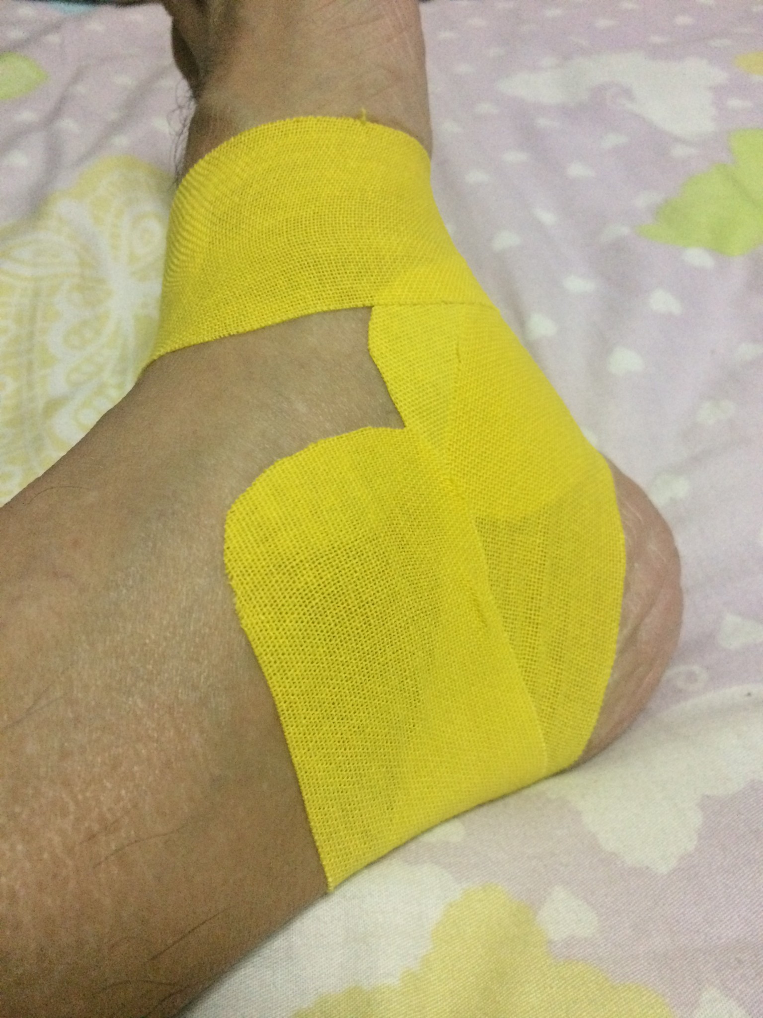 Amateurish taping